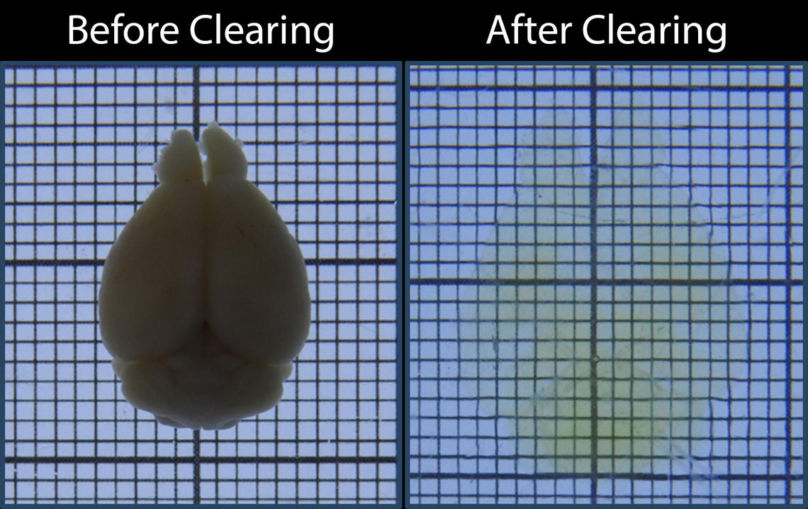 Tissue Clearing HBIAMP Cumming School of Medicine University of